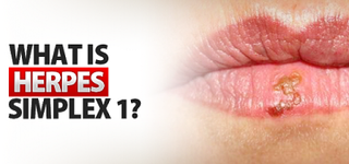 Illustration for article titled Cara Paling Ampuh mengatasi demam akibat herpes